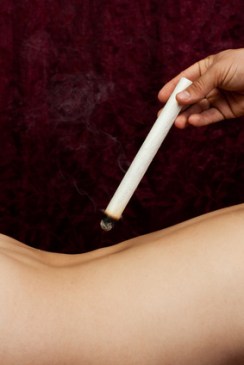 Moxa treatment on a womans back